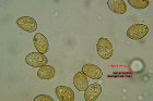 Microscopia - Agrocybe pediades 