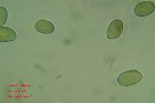 Microscopia - Amanita ponderosa 