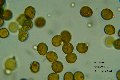 Microscopia - Amanita verna 