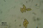 Microscopia - Boletus fragrans 