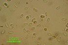 Microscopia - Calocybe gambosa