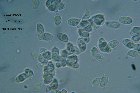 Microscopia - Clitocybe fragrans 