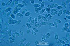 Microscopia - Clitocybe inornata 