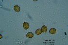 Microscopia - Cortinariu azureovelatus