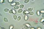Microscopia - Cortinarius croceus 