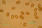 Microscopia - Cortinarius obtusus 