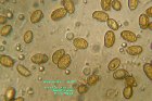 Microscopia - Cortinarius vernus 