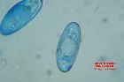 Microscopia - Discina leucoxantha1 