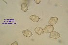 Microscopia - Entoloma hirtipes