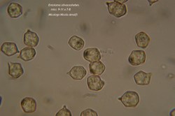 Microscopia - Entoloma olivaceohebes 
