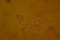 Microscopia - Gymnopus dysodes1