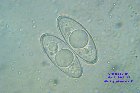 Microscopia - Gyromitra gigas