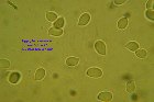 Microscopia - Hygrophorus marzuolus-