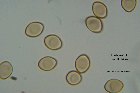Microscopia - Inocybe cerrvicolor