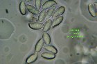 Microscopia - Lepiota alba 
