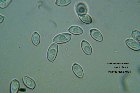 Microscopia - Leucoagaricus serenus 