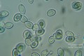Microscopia - Leucocoprinus brebissoni3