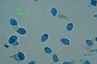 Microscopia - Marasmius oreades 