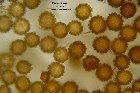Microscopia - Pisolithus arhizus 