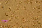 Microscopia - Pluteus brunneoradiatus