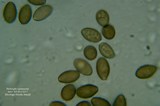 Microscopia - Psilocybe cyanescens1 