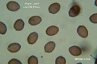 Microscopia - Psisilocybe coprophila