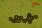 Microscopia - Russula pseudoromellii