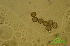 Microscopia - Russula vesca 