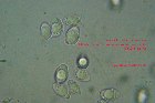 Microscopia - Tricholoma sulphureum 