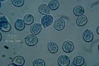 Microscopia - Xerula melanotricha1