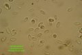 Microscopia - spore Calocybe gambosa