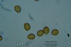 Microscopia - spore Cortinariu azureovelatus