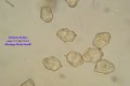 Microscopia - spore Entoloma hirtipes