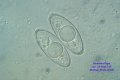 Microscopia - spore Gyromitra gigas