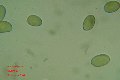 Microscopia - spore amanita ponderosa 