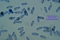 Microscopia - spore polyporus arcularius