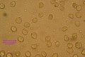 Microscopia - sporepluteus brunneoradiatus